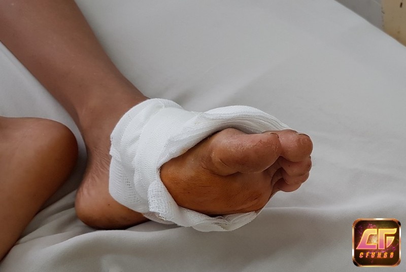 Giấc mơ thấy bị thương ở chân thể hiện những trở ngại trên con đường phía trước của bạn