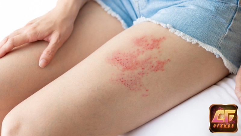 Giấc mơ thấy người thân bị thương phản ánh sự lo lắng của bạn với người thân