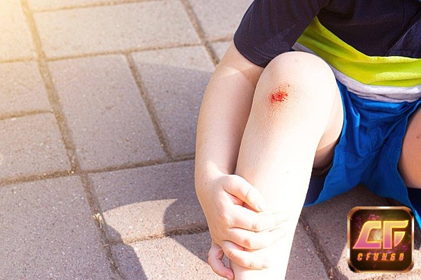 Giấc mơ thấy bị thương đánh số gì mang đến cho bạn nhiều con số may mắn mỗi ngày