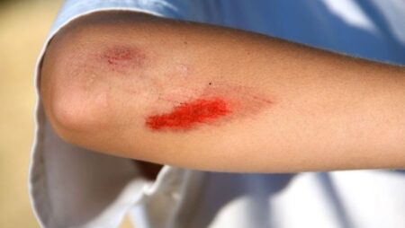 Mơ thấy bị thương đánh số gì? Điềm báo lành hay dữ?