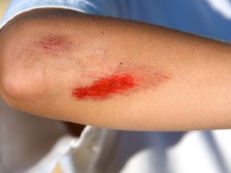 Mơ thấy bị thương đánh số gì? Điềm báo lành hay dữ?