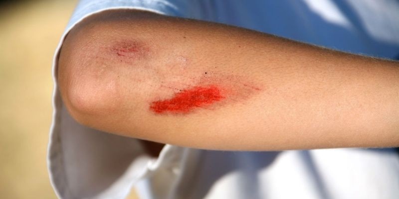 Mơ thấy bị thương đánh số gì? Điềm báo lành hay dữ?