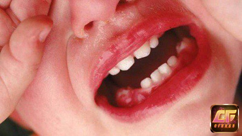Giải mã giấc mơ thấy gãy răng chảy máu mang đến cho bạn nhiều con số may mắn mỗi ngày
